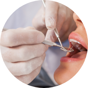 Dental Implant Process image2